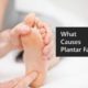 What Causes Plantar Fasciitis To Flare Up?